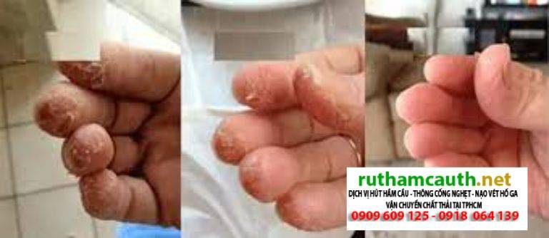 Bột Thông Cống Dính Vào Tay Phải Làm Sao? Lưu Ý Khi Sử Dụng