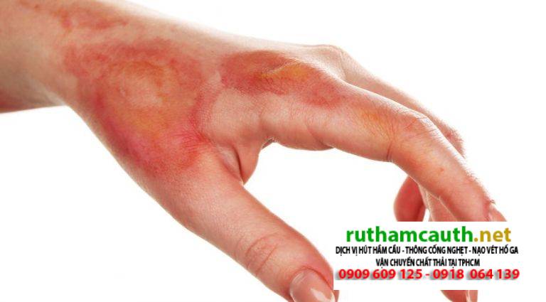 Thành Phần Và Tác Hại Của Bột Thông Cống Đối Với Cơ Thể